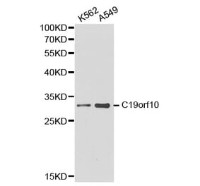 Western blot - C19orf10 antibody from Signalway Antibody (38186) - Antibodies.com