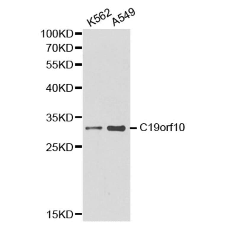 Western blot - C19orf10 antibody from Signalway Antibody (38186) - Antibodies.com