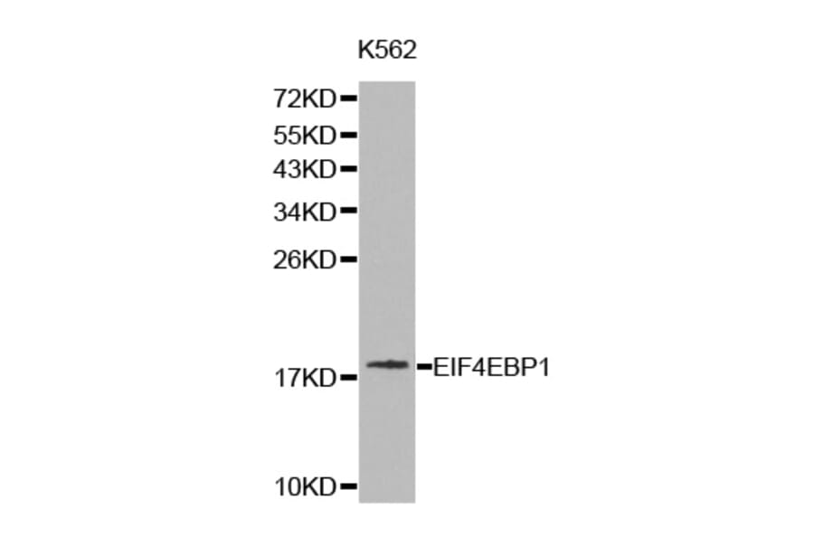 Western blot - EIF4EBP1 antibody from Signalway Antibody (38227) - Antibodies.com