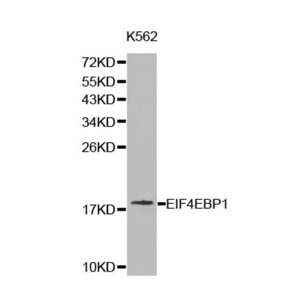 Western blot - EIF4EBP1 antibody from Signalway Antibody (38227) - Antibodies.com