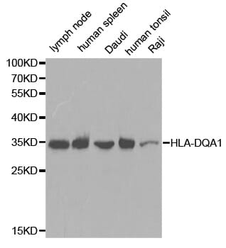 Western blot analysis of extracts of various cell lines, using HLA-DQA1 antibody.