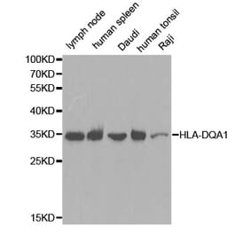 Western blot - HLA-DQA1 antibody from Signalway Antibody (38391) - Antibodies.com