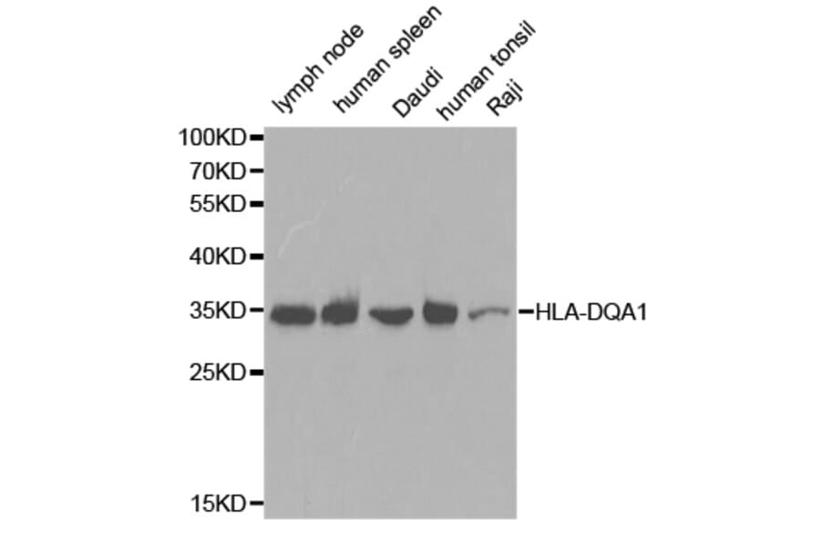Western blot - HLA-DQA1 antibody from Signalway Antibody (38391) - Antibodies.com