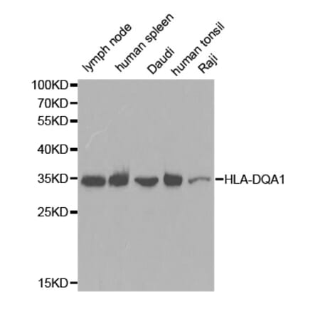 Western blot - HLA-DQA1 antibody from Signalway Antibody (38391) - Antibodies.com