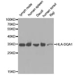 Western blot - HLA-DQA1 antibody from Signalway Antibody (38391) - Antibodies.com
