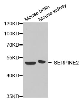 Western blot analysis of extracts of various cell lines, using SERPINE2 antibody.