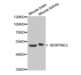 Western blot - SERPINE2 antibody from Signalway Antibody (38643) - Antibodies.com