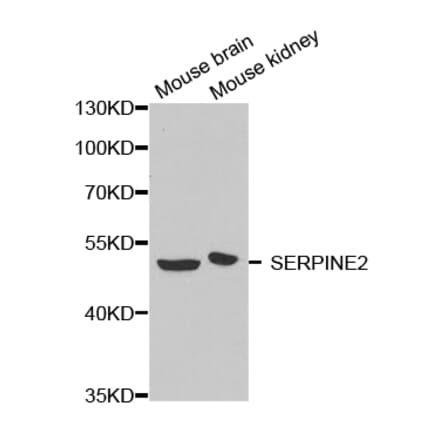 Western blot - SERPINE2 antibody from Signalway Antibody (38643) - Antibodies.com