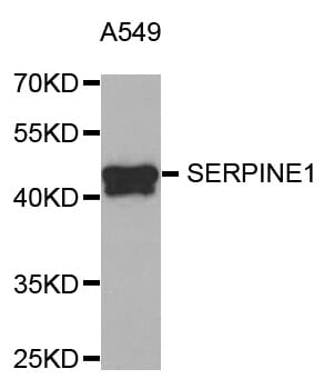 Western blot analysis of extracts of A549 cell line, using SERPINE1 antibody.