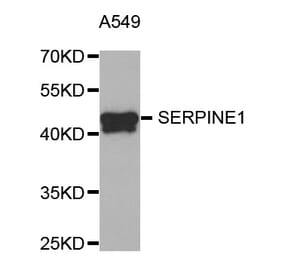 Western blot - SERPINE1 antibody from Signalway Antibody (38751) - Antibodies.com