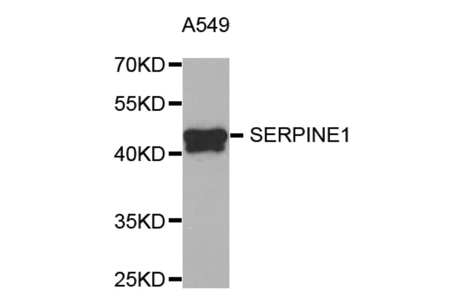 Western blot - SERPINE1 antibody from Signalway Antibody (38751) - Antibodies.com