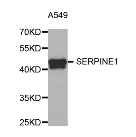 Western blot - SERPINE1 antibody from Signalway Antibody (38751) - Antibodies.com