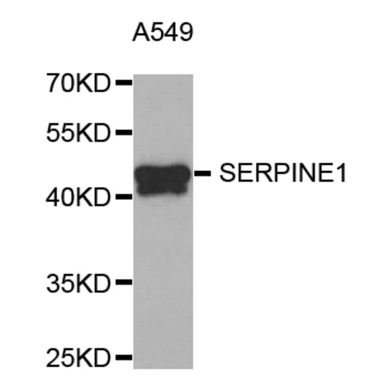 Western blot - SERPINE1 antibody from Signalway Antibody (38751) - Antibodies.com