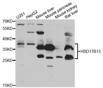 Western blot analysis of extracts of various cell lines, using HSD17B13 antibody.