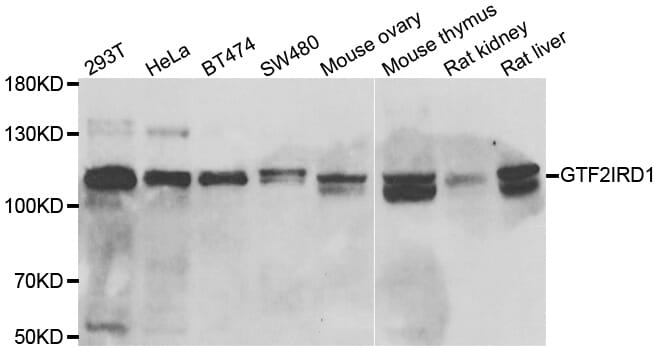 Western blot analysis of extracts of various cell lines, using GTF2IRD1 antibody.