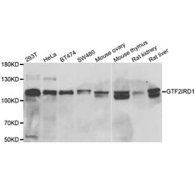 Western blot - GTF2IRD1 antibody from Signalway Antibody (39045) - Antibodies.com