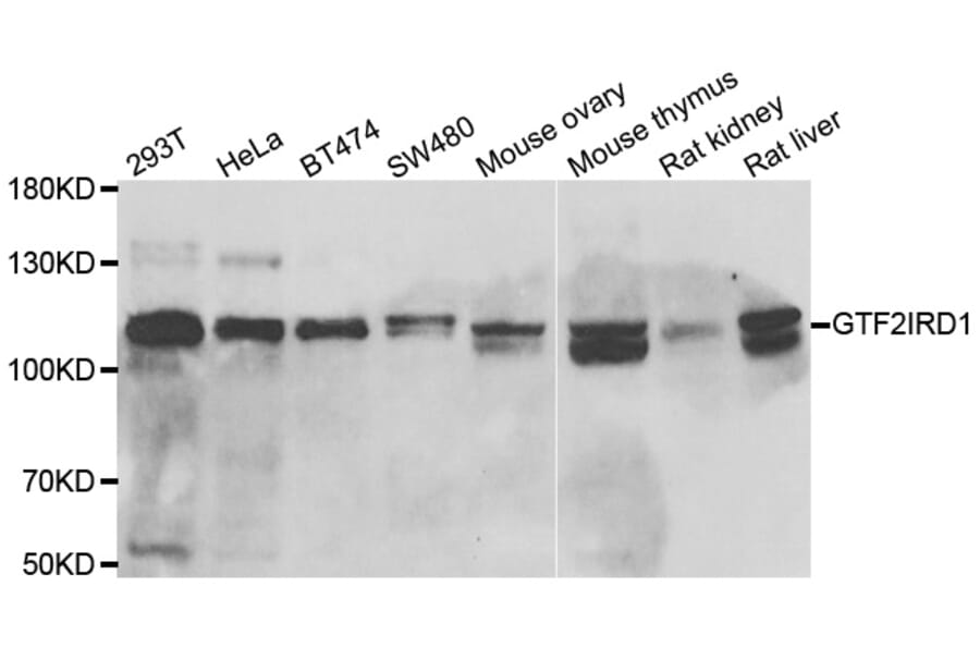 Western blot - GTF2IRD1 antibody from Signalway Antibody (39045) - Antibodies.com