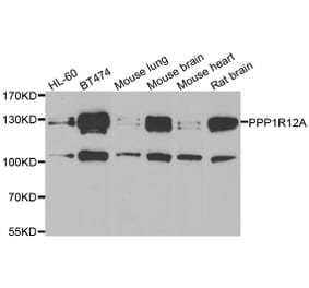 Western blot - PPP1R12A antibody from Signalway Antibody (39113) - Antibodies.com