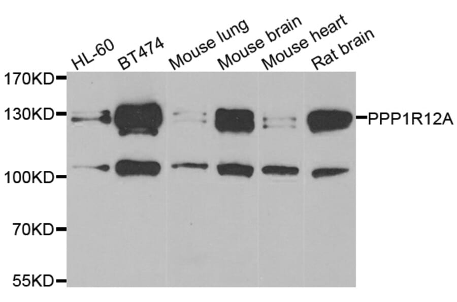 Western blot - PPP1R12A antibody from Signalway Antibody (39113) - Antibodies.com