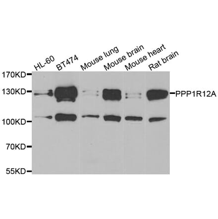 Western blot - PPP1R12A antibody from Signalway Antibody (39113) - Antibodies.com