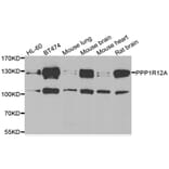 Western blot - PPP1R12A antibody from Signalway Antibody (39113) - Antibodies.com