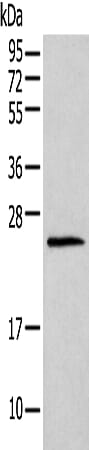 Gel: 12% SDS-PAGE Lysate: 40 &#956;g Lane: Mouse lung tissue Primary antibody: 1/400 dilution Secondary antibody: Goat anti rabbit IgG at 1/8000 dilution Exposure time: 1 minute