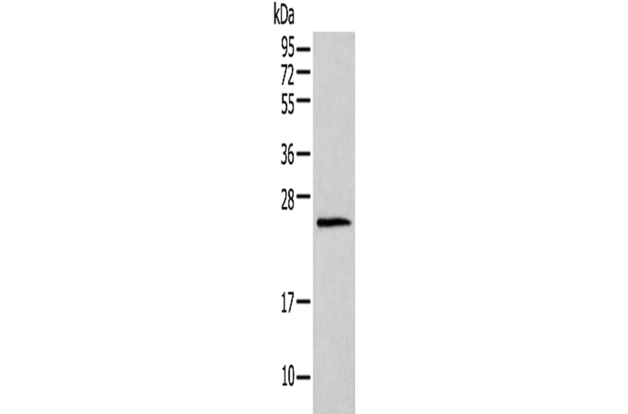 HIST1H1T Antibody from Signalway Antibody (42925) - Antibodies.com