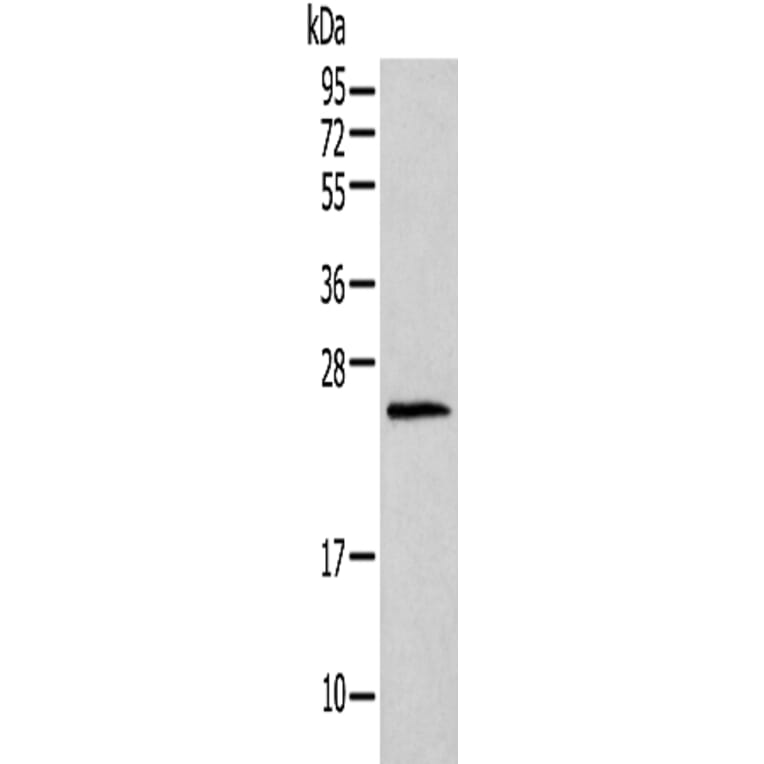 HIST1H1T Antibody from Signalway Antibody (42925) - Antibodies.com