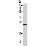 HIST1H1T Antibody from Signalway Antibody (42925) - Antibodies.com