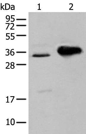 Gel: 12% SDS-PAGE Lysate: 40 &#956;g, Lane 1-2: TM4 cell and Mouse brain tissue, Primary antibody: ATP6V1E2 antibody at dilution 1/400 dilution, Secondary antibody: Goat anti rabbit IgG at 1/8000 dilution, Exposure time: 5 seconds
