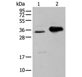 ATP6V1E2 Antibody from Signalway Antibody (43883) - Antibodies.com