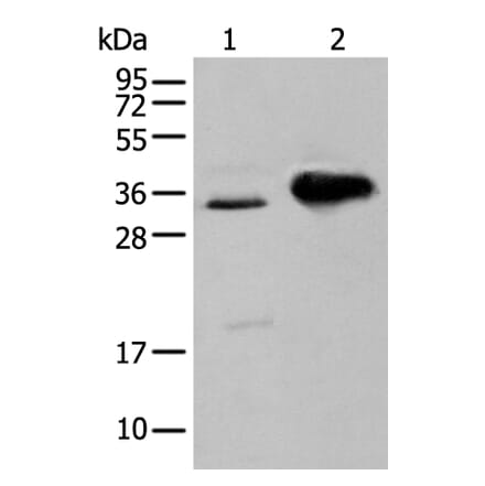 ATP6V1E2 Antibody from Signalway Antibody (43883) - Antibodies.com