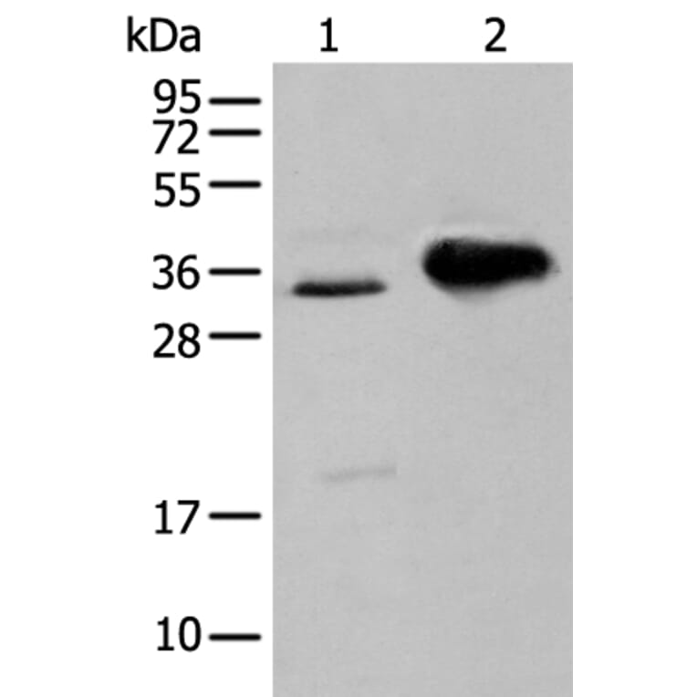 ATP6V1E2 Antibody from Signalway Antibody (43883) - Antibodies.com