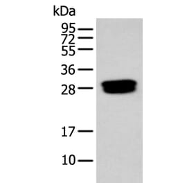 GLIPR1L1 Antibody from Signalway Antibody (43884) - Antibodies.com