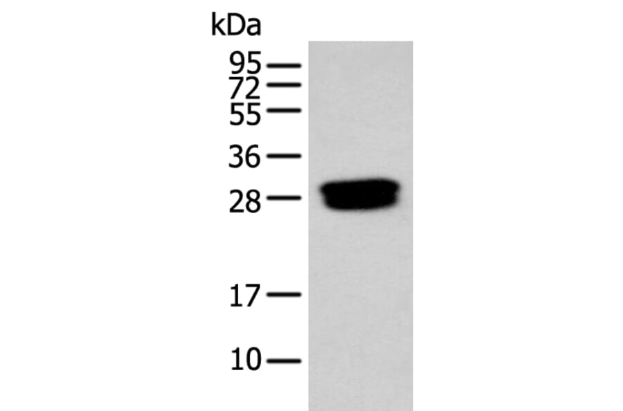 GLIPR1L1 Antibody from Signalway Antibody (43884) - Antibodies.com