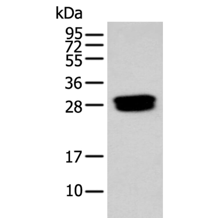 GLIPR1L1 Antibody from Signalway Antibody (43884) - Antibodies.com