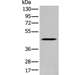 SERPINB7 Antibody from Signalway Antibody (43950) - Antibodies.com