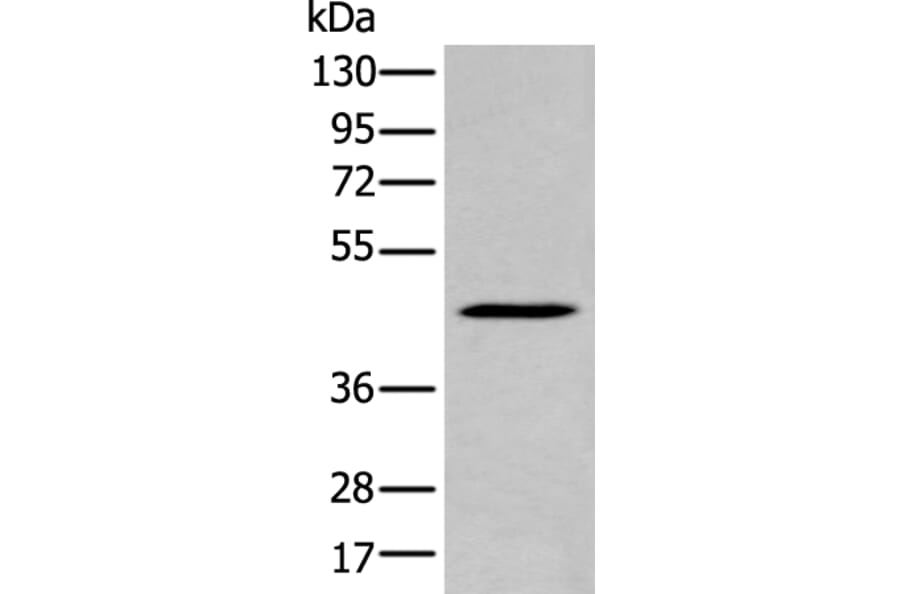 SERPINB7 Antibody from Signalway Antibody (43950) - Antibodies.com