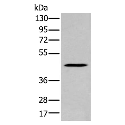 SERPINB7 Antibody from Signalway Antibody (43950) - Antibodies.com