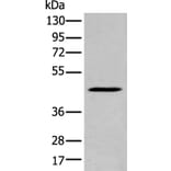 SERPINB7 Antibody from Signalway Antibody (43950) - Antibodies.com