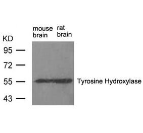 Western blot - Tyrosine Hydroxylase (Ab-31) Antibody from Signalway Antibody (21294) - Antibodies.com