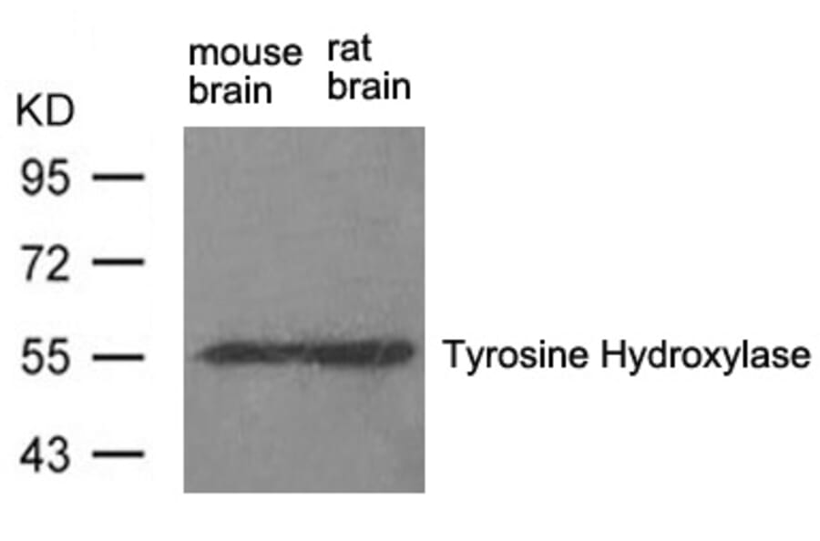 Western blot - Tyrosine Hydroxylase (Ab-31) Antibody from Signalway Antibody (21294) - Antibodies.com