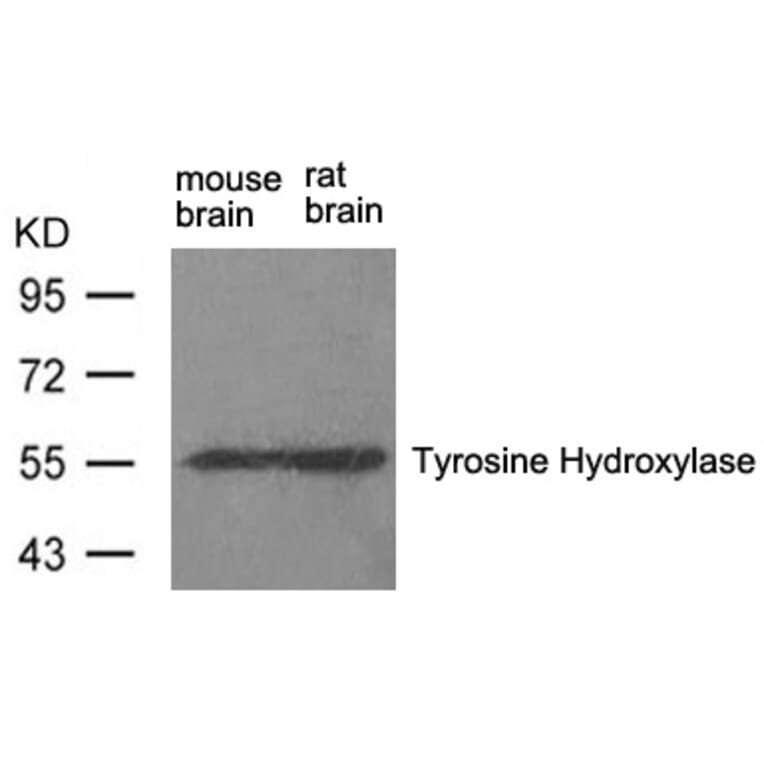 Western blot - Tyrosine Hydroxylase (Ab-31) Antibody from Signalway Antibody (21294) - Antibodies.com