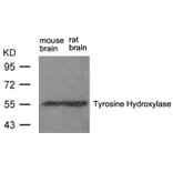 Western blot - Tyrosine Hydroxylase (Ab-31) Antibody from Signalway Antibody (21294) - Antibodies.com