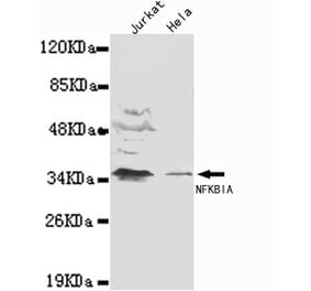 IkB-alpha (N-term) Monoclonal Antibody from Signalway Antibody (27065) - Antibodies.com