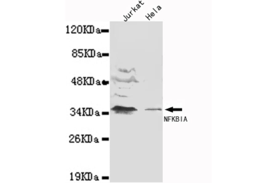 IkB-alpha (N-term) Monoclonal Antibody from Signalway Antibody (27065) - Antibodies.com