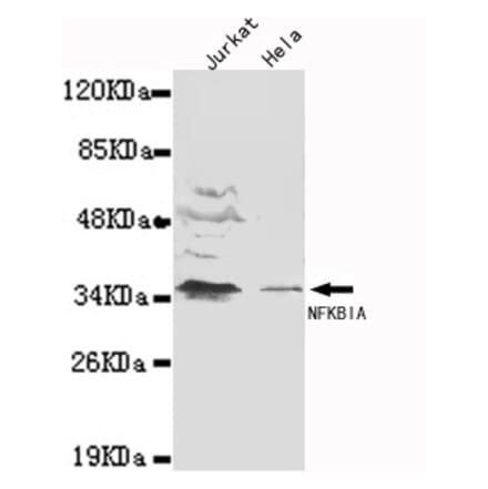 IkB-alpha (N-term) Monoclonal Antibody from Signalway Antibody (27065) - Antibodies.com