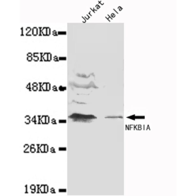 IkB-alpha (N-term) Monoclonal Antibody from Signalway Antibody (27065) - Antibodies.com