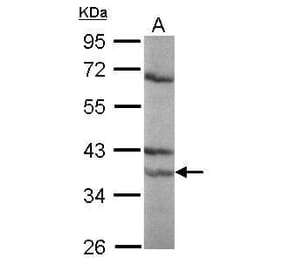 Retinoic Acid Receptor alpha Antibody from Signalway Antibody (35355) - Antibodies.com