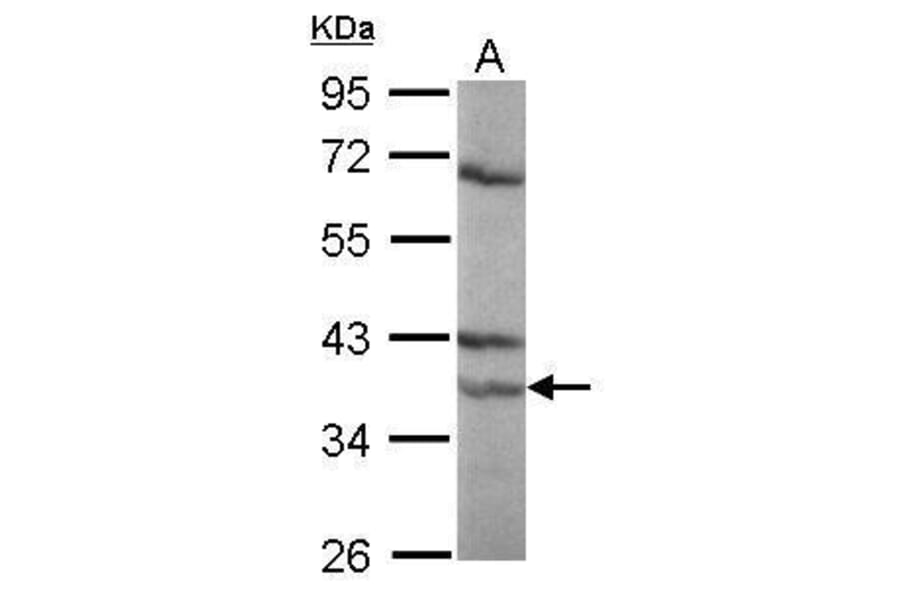 Retinoic Acid Receptor alpha Antibody from Signalway Antibody (35355) - Antibodies.com